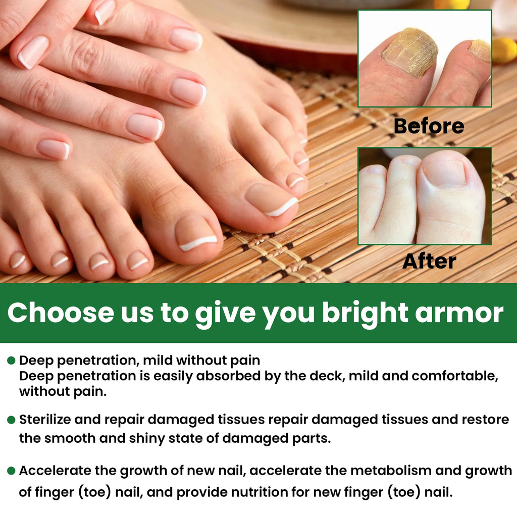 Nail Repair & Strengthening LiquidRepairs and nourishes nails, brightens, moisturizes and protects, for hand & foot nail care.