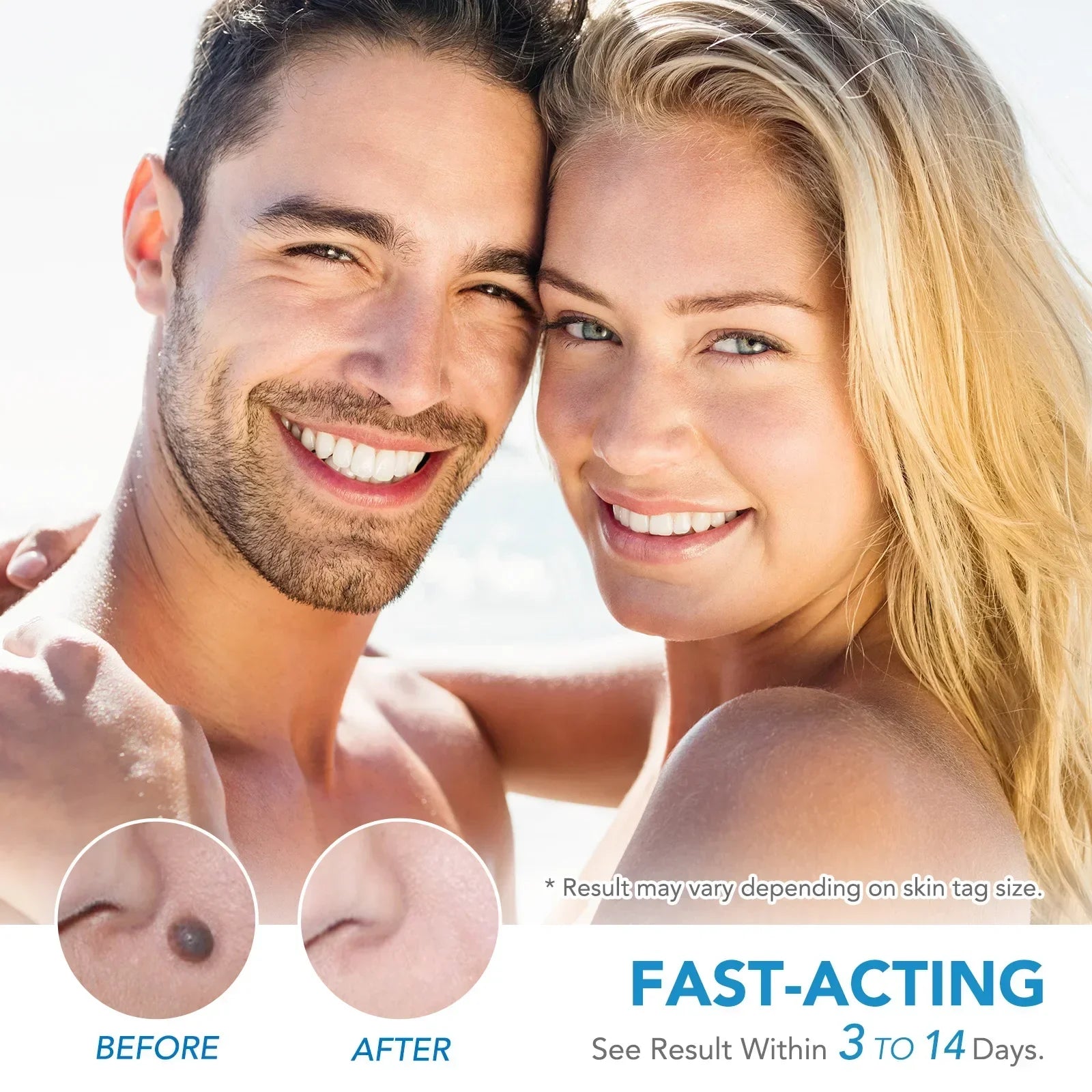 Skin Tag Removal Care Products Simple Wart Removal Tool Set Skin Tag Removeal Tool Easy To Clean Skin Care Tool