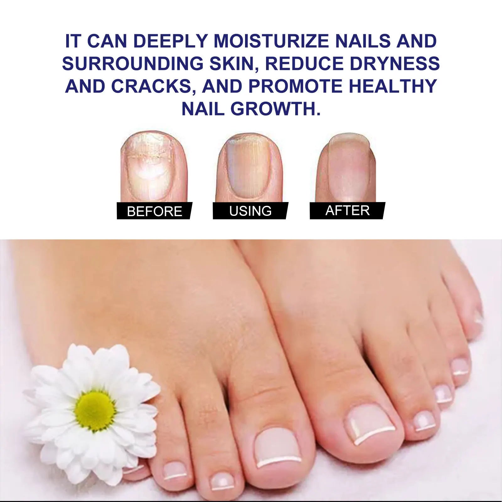 Nail Care, Repair, Soft Hands and Feet, Thickened and Shiny Nails, Moisturizing and Cleaning Nail Care Solution