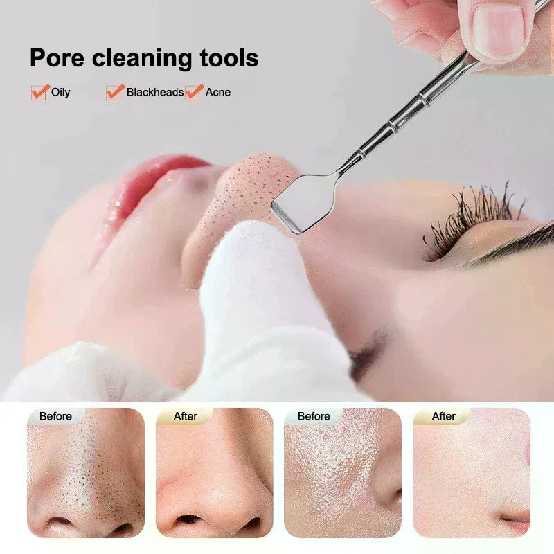 Facial Blackhead Removal Tool Face Scraper For Deep Cleansing Face Spatula Nose Whitehead Remover Skin Care Beauty Tools
