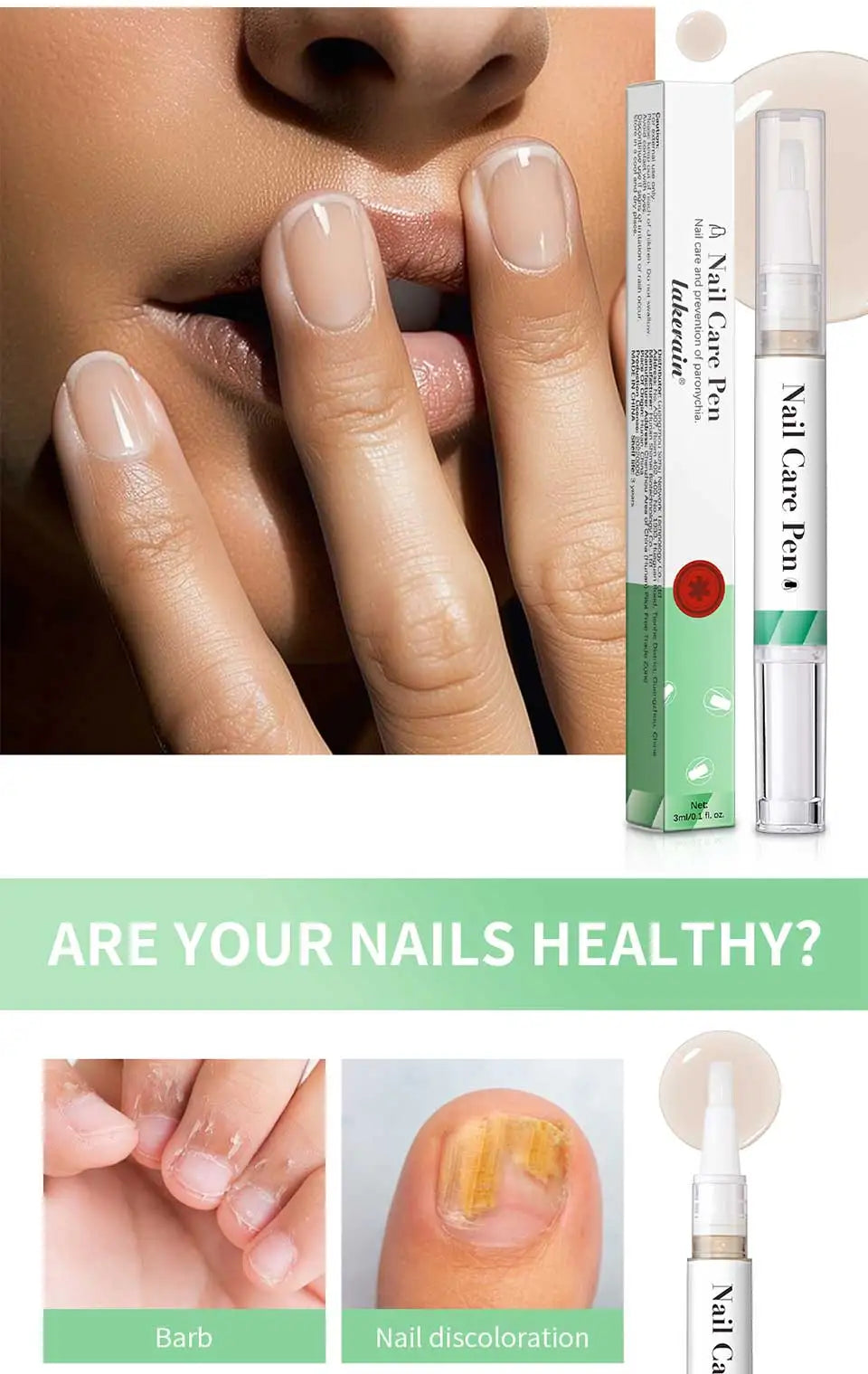 1/2pc Nail Care Mild Ingredients Prevent Damaged Nail Bed Treat Onychomycosis Nail Repair Pen For Nail Beauty Health Care Tool