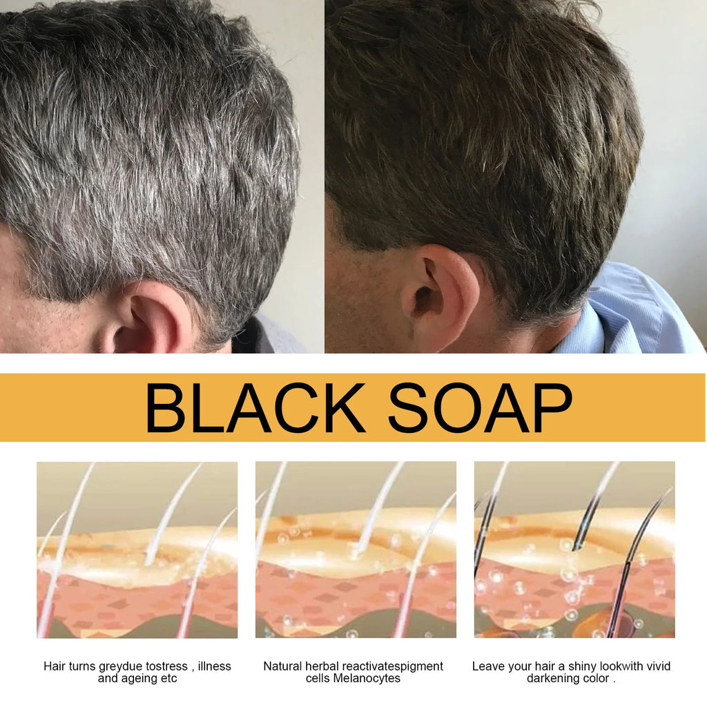 Hair strengthening shampoo soap, hair soap, cleansing scalp, soften hair strong hair, men and women usually hair care products,