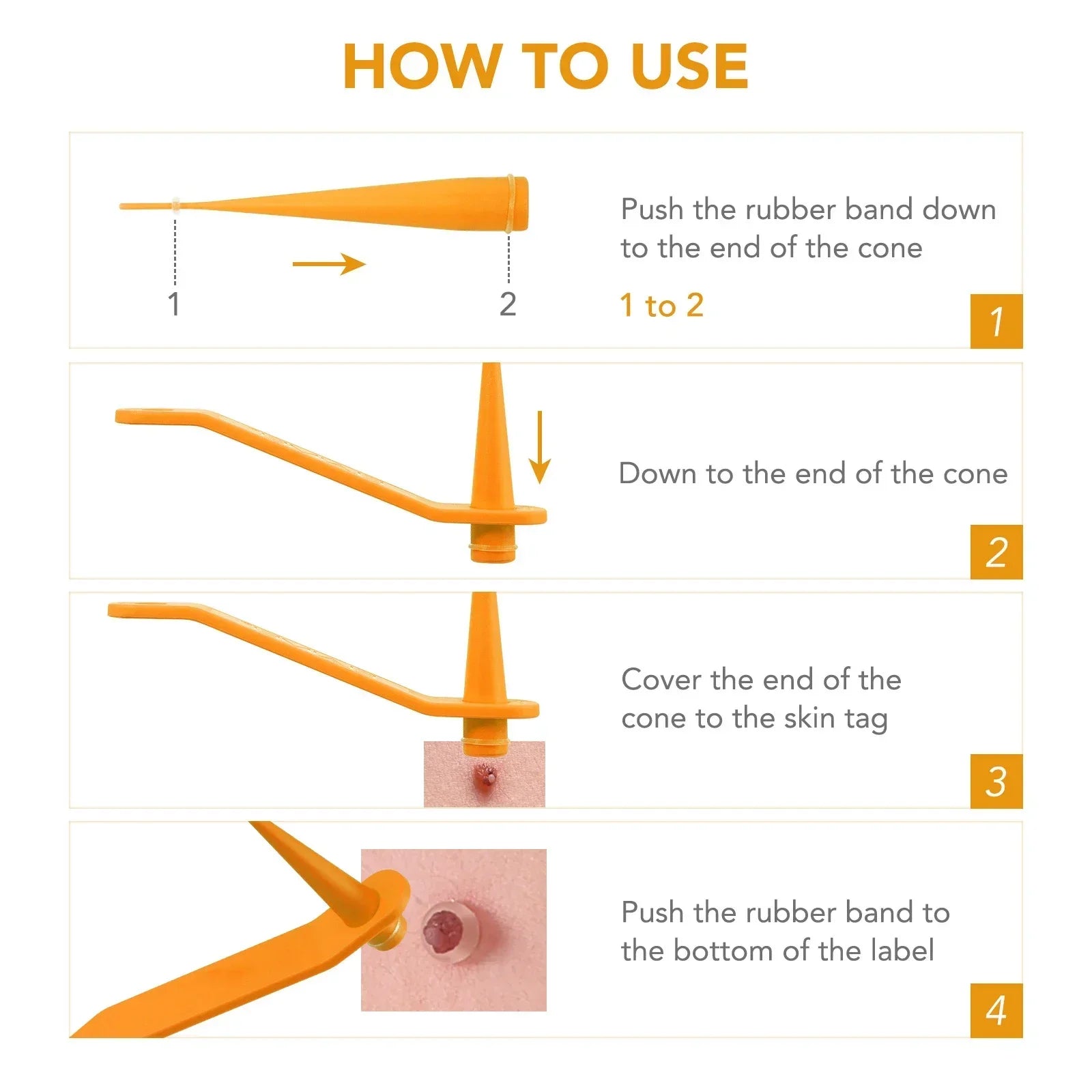 Skin Tag Removal Care Products Simple Wart Removal Tool Set Skin Tag Removeal Tool Easy To Clean Skin Care Tool
