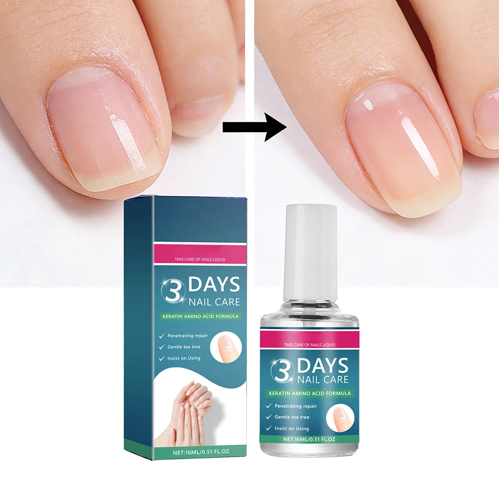Nail Care Serum,Nail Repair Treatments Oil,Keratins Amino Acid Nail Care Oil Strengthen Restore Nails Quickly,Nail Care Product