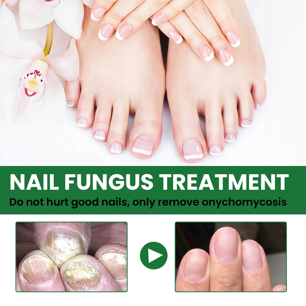 Nail Repair & Strengthening LiquidRepairs and nourishes nails, brightens, moisturizes and protects, for hand & foot nail care.