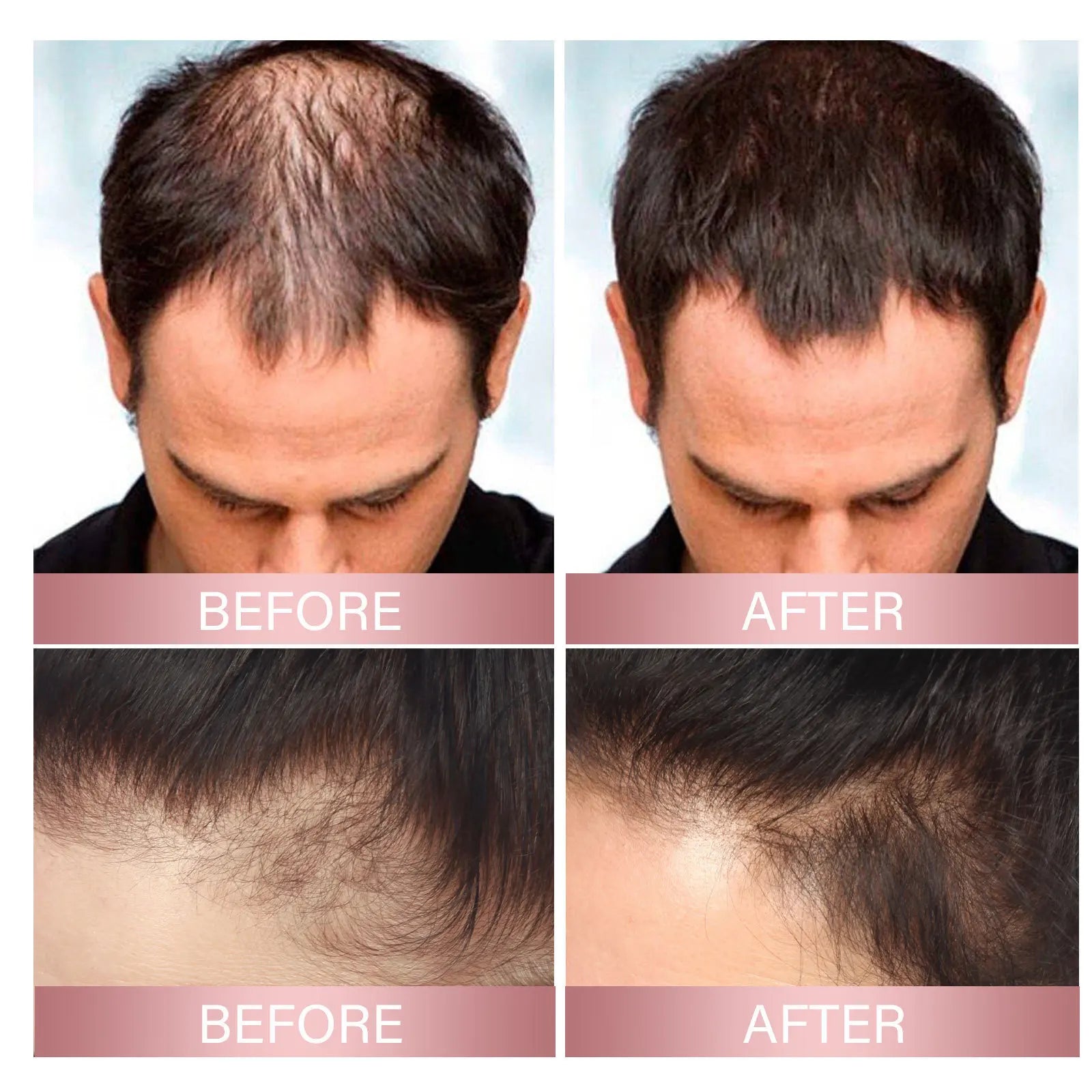 Rice Hair Care Spray Strong Hair Moisturizing Scalp Supple Nourishing Lustrous Moisturizing Hair Care