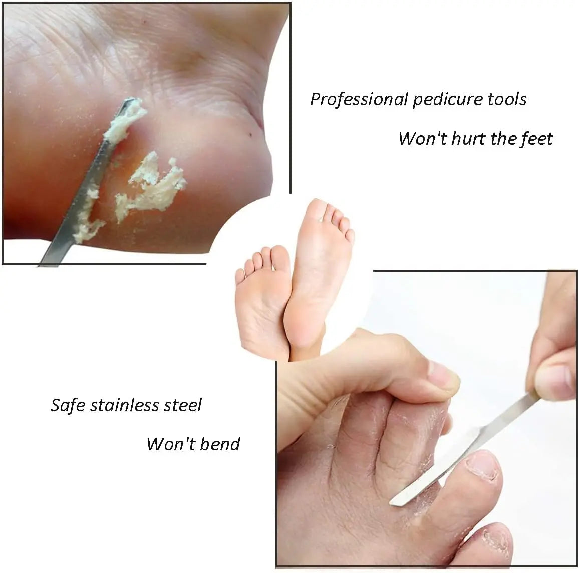 Pedicure Knife Tools , Professional Stainless Steel Foot Scrubber Dead Skin Remover ,Remove Dead Skin  Scraping Pedicure Tools