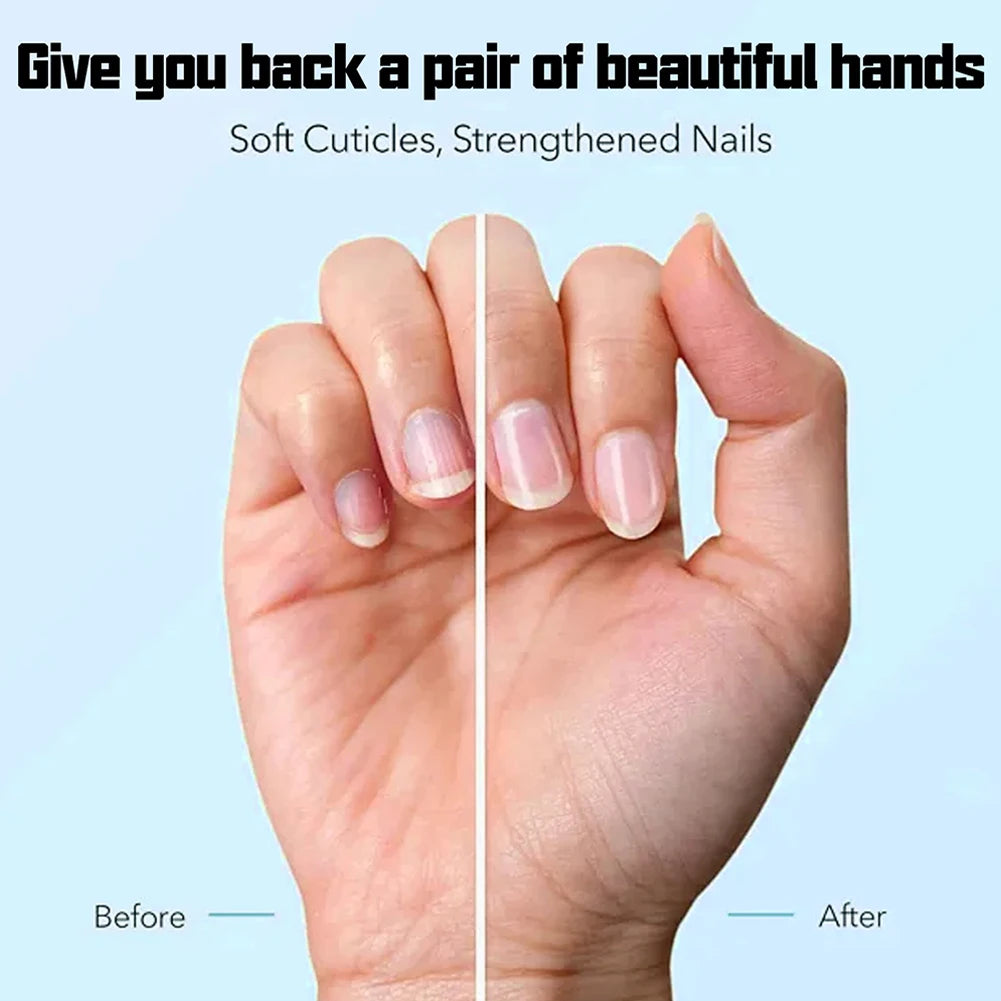 Nail Care Serum,Nail Repair Treatments Oil,Keratins Amino Acid Nail Care Oil Strengthen Restore Nails Quickly,Nail Care Product