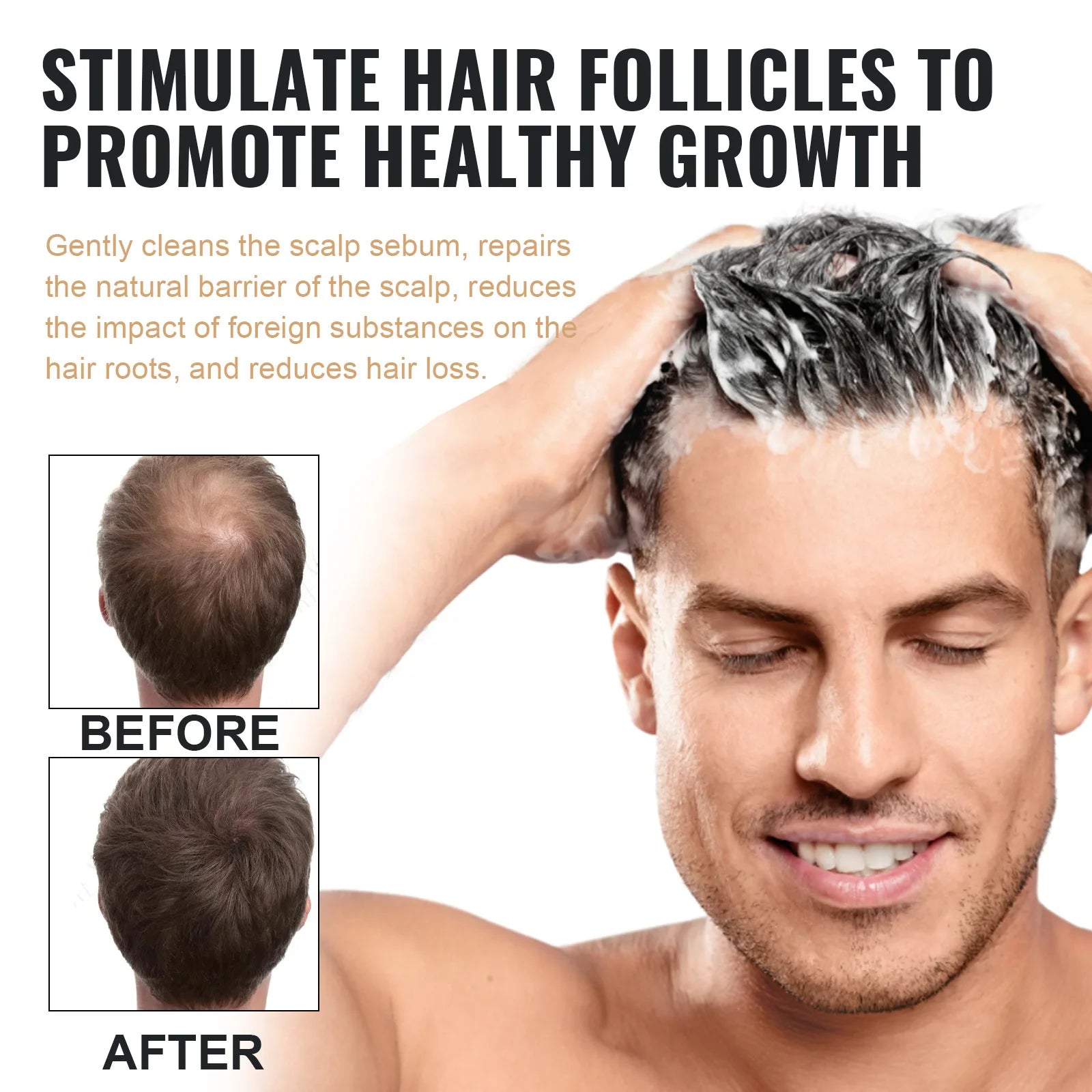 Hair Loss Treatment Shampoo Promote Growth Strengthen Hair Roots Scalp Repair Anti Thinning Moisturizing Thickening Hair Care