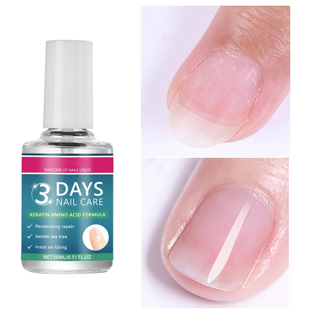 Nail Care Serum,Nail Repair Treatments Oil,Keratins Amino Acid Nail Care Oil Strengthen Restore Nails Quickly,Nail Care Product