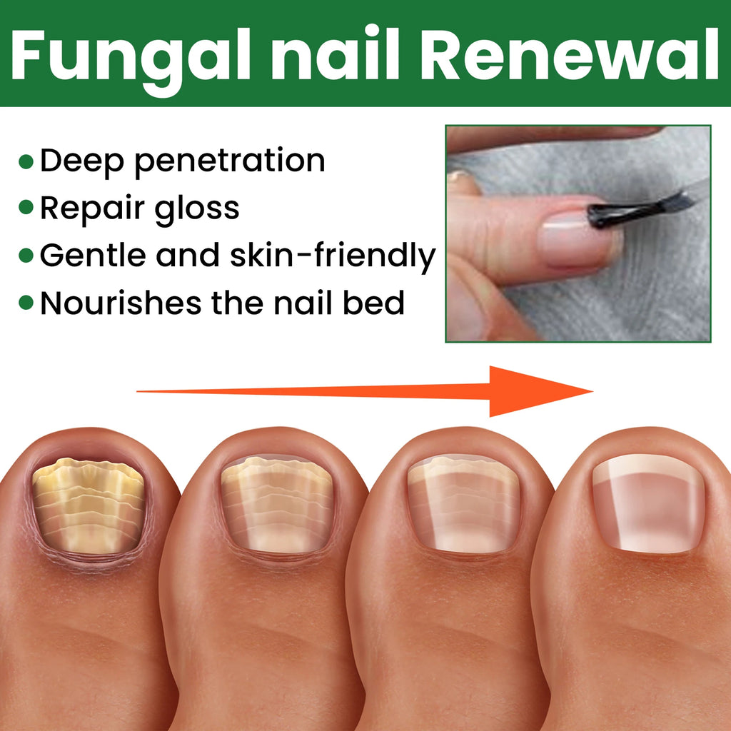 Nail Repair & Strengthening LiquidRepairs and nourishes nails, brightens, moisturizes and protects, for hand & foot nail care.