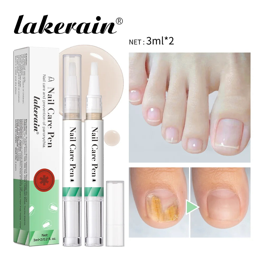 1/2pc Nail Care Mild Ingredients Prevent Damaged Nail Bed Treat Onychomycosis Nail Repair Pen For Nail Beauty Health Care Tool