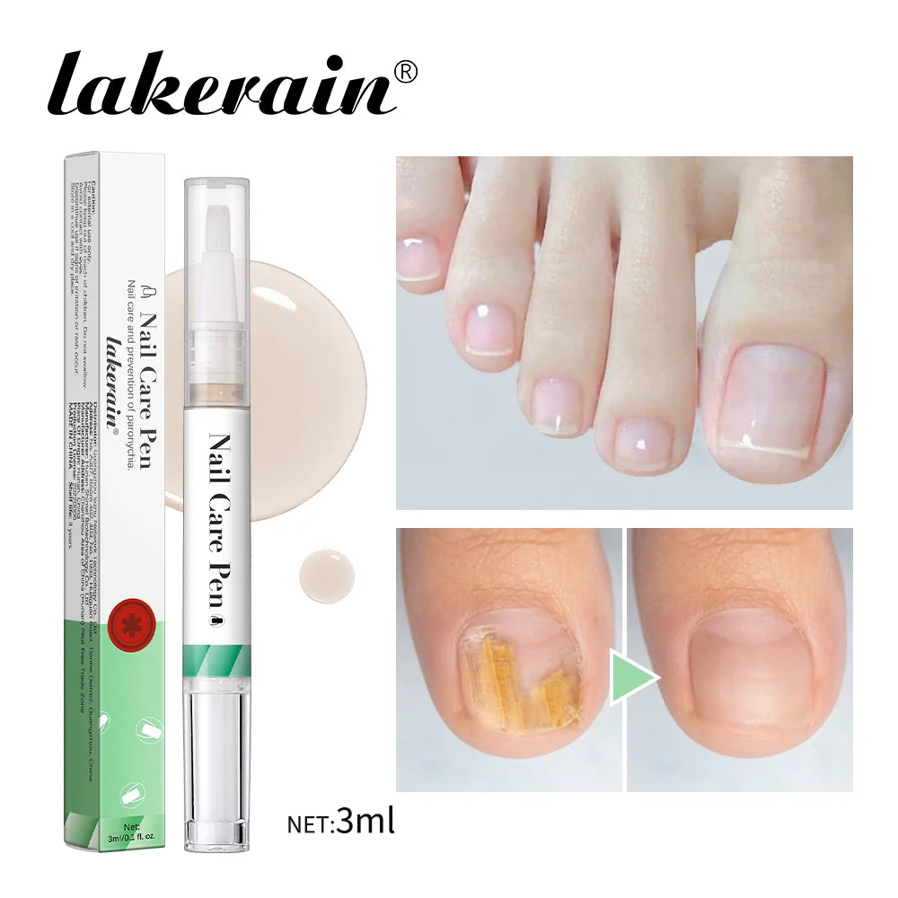 1/2pc Nail Care Mild Ingredients Prevent Damaged Nail Bed Treat Onychomycosis Nail Repair Pen For Nail Beauty Health Care Tool
