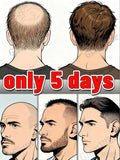 Sᴀʟᴏɴ-ɢʀᴀᴅᴇ hair spray, buy now and enjoy amazing discounts