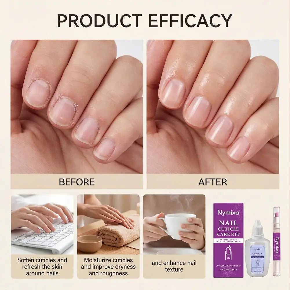 Nail Cuticle Care Kit 50ml Remover Cream 2ml Oil Pen Salon Quality Manicure Set Fingernails Toenails Healthy Grooming Portable