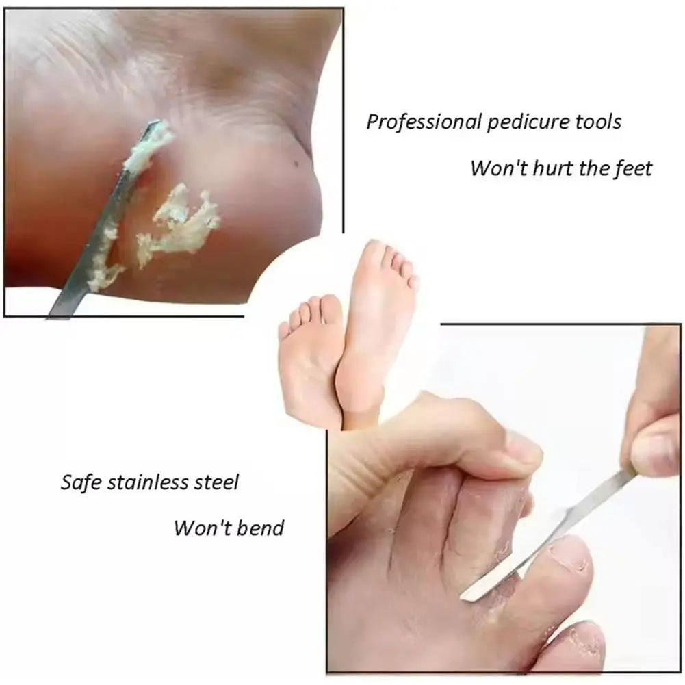 Manicure Pedicure Tools Toe Nail Shaver Feet Pedicure Knife Kit Foot Callus Rasp File Dead Skin Remover Foot Care Tools