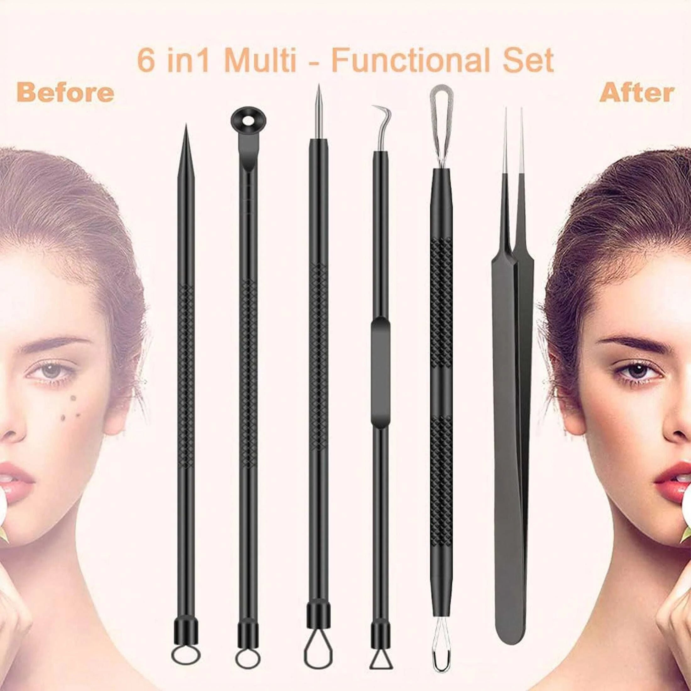 6-Piece Acne Tool Set Blackhead Extractor Facial Care - Facial Acne Removal Tweezers and Needle Stainless Steel Care Tools