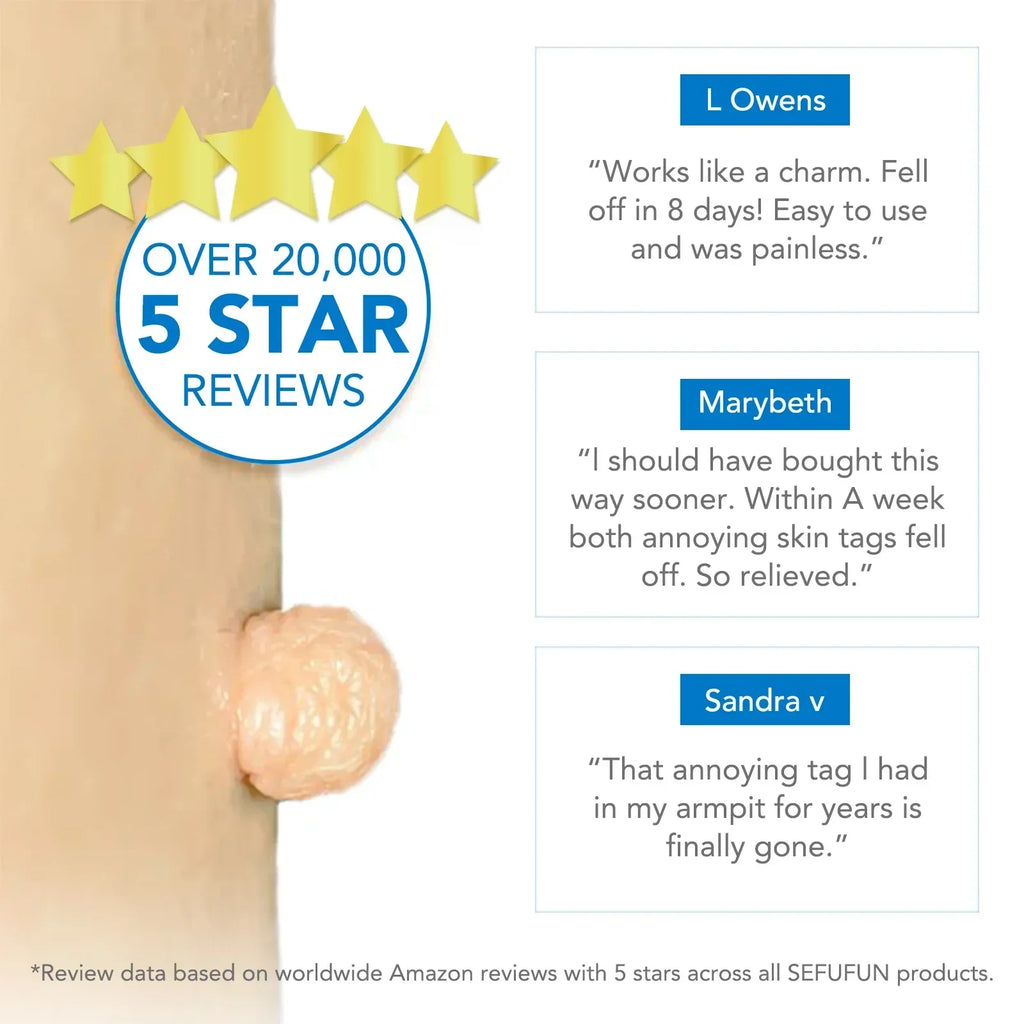 Skin Tag Removal Care Products Simple Wart Removal Tool Set Skin Tag Removeal Tool Easy To Clean Skin Care Tool
