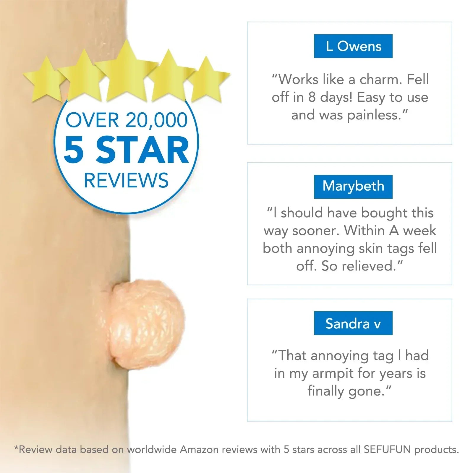 Skin Tag Removal Care Products Simple Wart Removal Tool Set Skin Tag Removeal Tool Easy To Clean Skin Care Tool