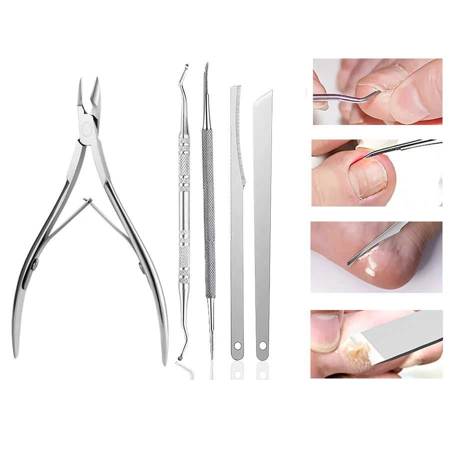 Stainless Steel Nail Care Kit, Cuticle Trimmer, Nail Cuticle Nippers, Ingrown Toenail Removal Kit,removal and foot repair tools