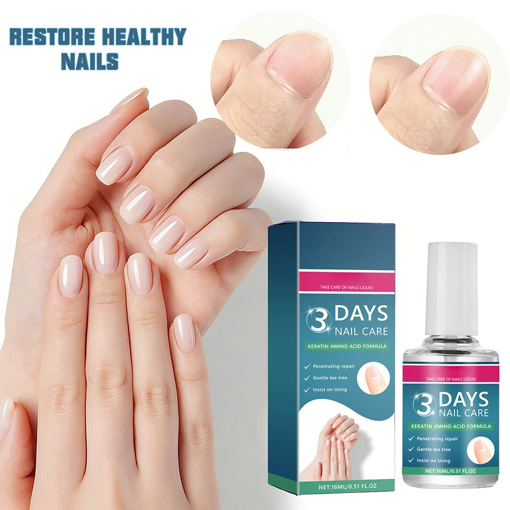 Nail Care Serum,Nail Repair Treatments Oil,Keratins Amino Acid Nail Care Oil Strengthen Restore Nails Quickly,Nail Care Product