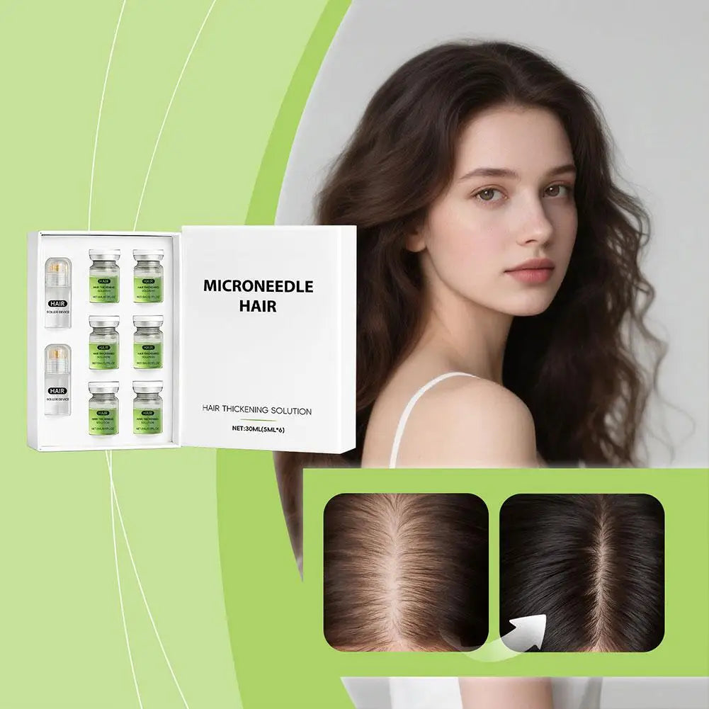Hair Roller Serum Gentle nourishes the scalp Strong Hair Root Anti Hair Loss Hair Care Set  Daily Care Scalp Serum