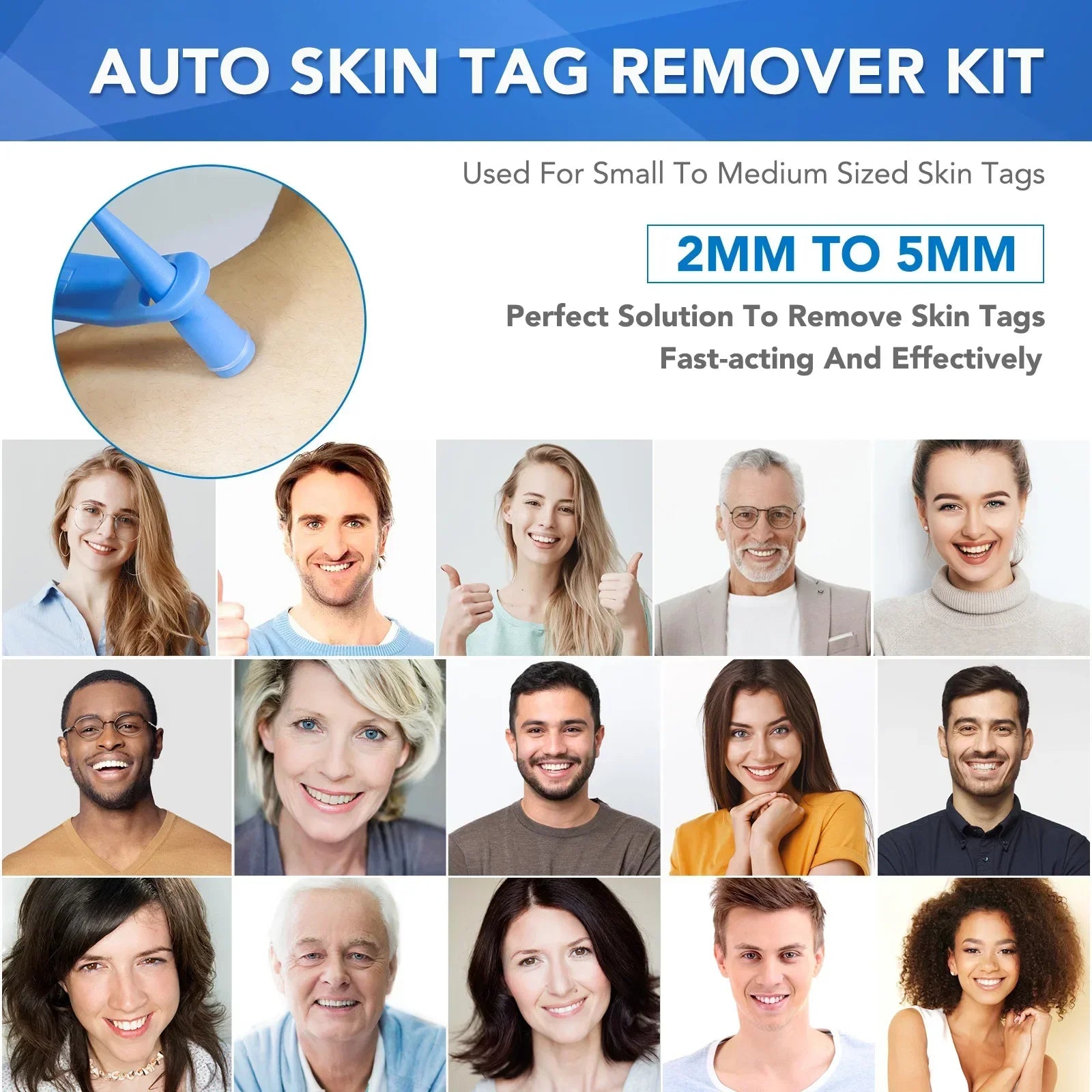 Skin Tag Removal Care Products Simple Wart Removal Tool Set Skin Tag Removeal Tool Easy To Clean Skin Care Tool