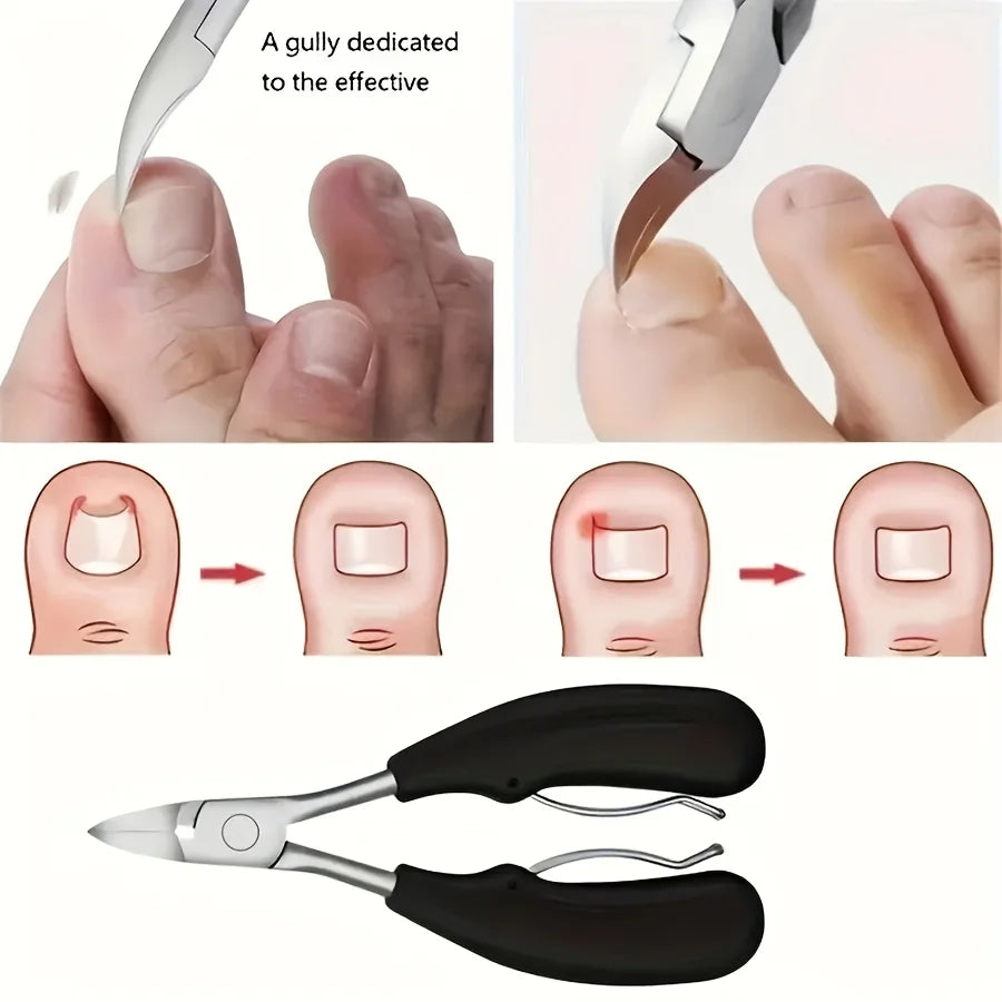 1/5Pcs Nail Care Kit for Ingrown & Thick Toenails - Heavy-Duty Clippers Set with Nail File, Cuticle Nippers, and Grooming Tools