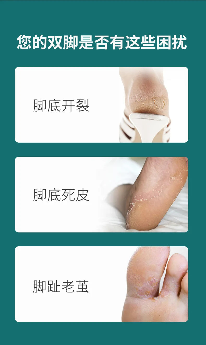 Stainless Steel Pedicure Knife Tools Professional Foot Scrubber Dead Skin Remover Exfoliating Foot Scraper Knife Foot Care Tool