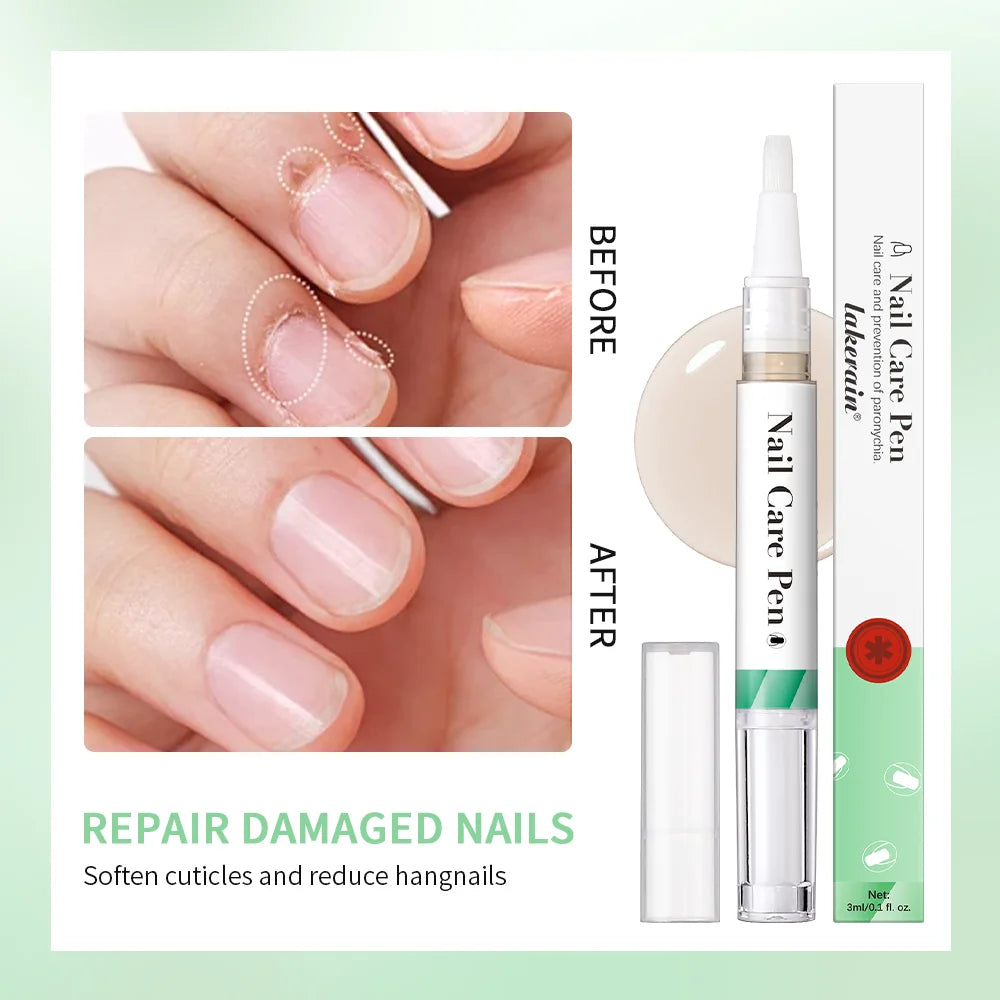 1/2pc Nail Care Mild Ingredients Prevent Damaged Nail Bed Treat Onychomycosis Nail Repair Pen For Nail Beauty Health Care Tool