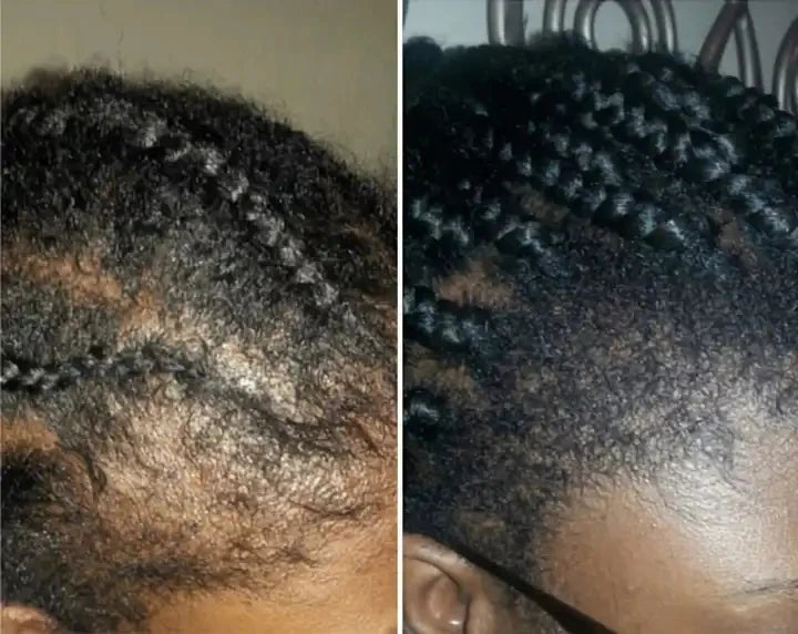Hair Growth Shampoo Ancient African Hair Growth Formula Extract Powerful Effect Fast Hair Loss Treatment Hair Care 100ml