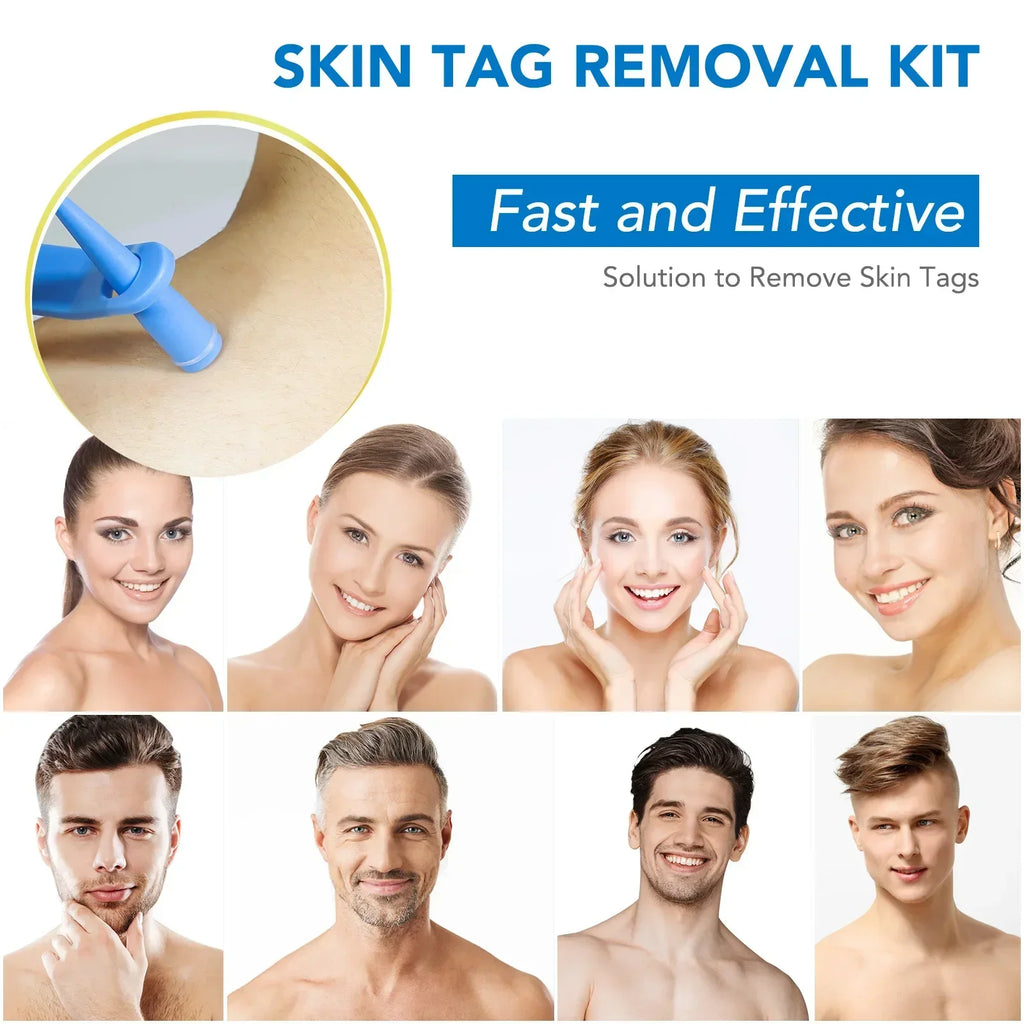 Skin Tag Removal Care Products Simple Wart Removal Tool Set Skin Tag Removeal Tool Easy To Clean Skin Care Tool