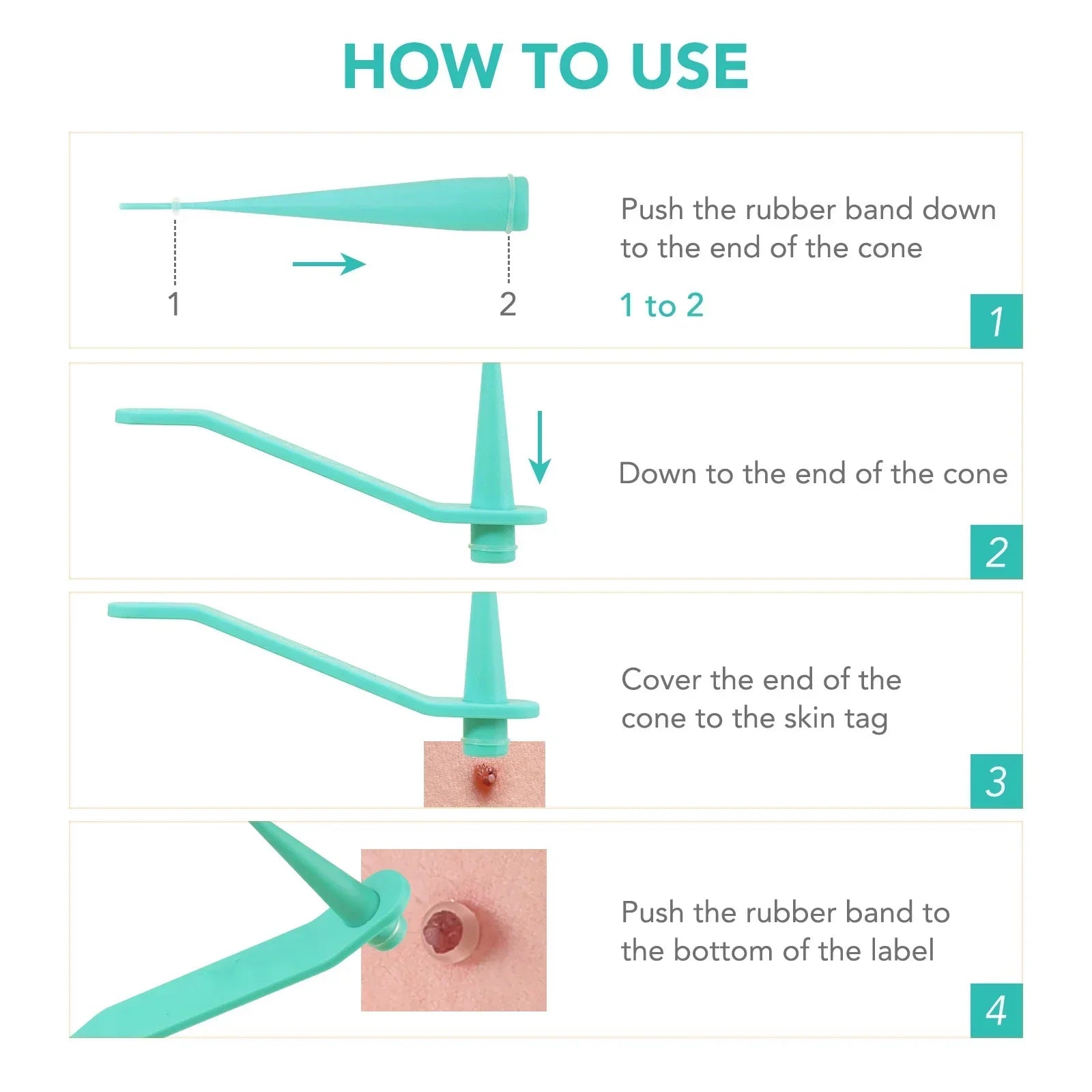 Skin Tag Removal Care Products Simple Wart Removal Tool Set Skin Tag Removeal Tool Easy To Clean Skin Care Tool