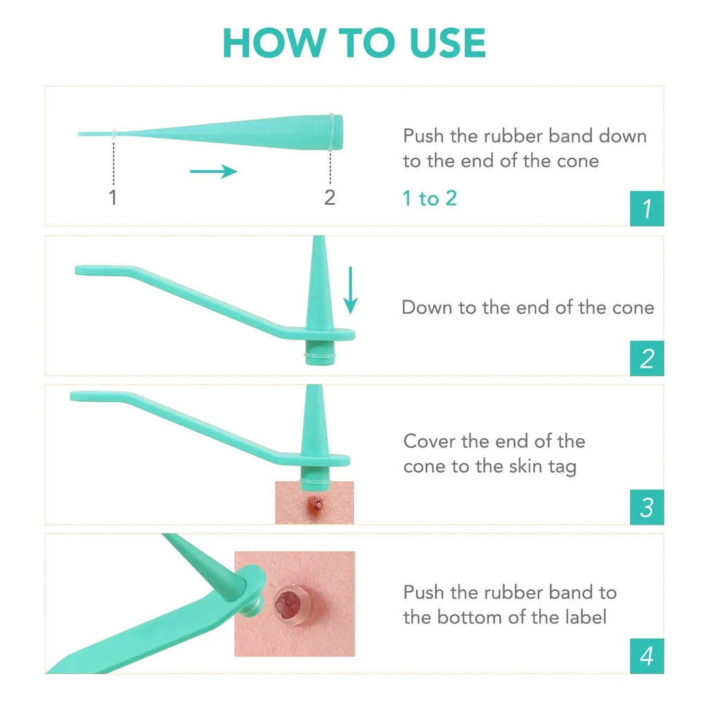Skin Tag Removal Care Products Simple Wart Removal Tool Set Skin Tag Removeal Tool Easy To Clean Skin Care Tool