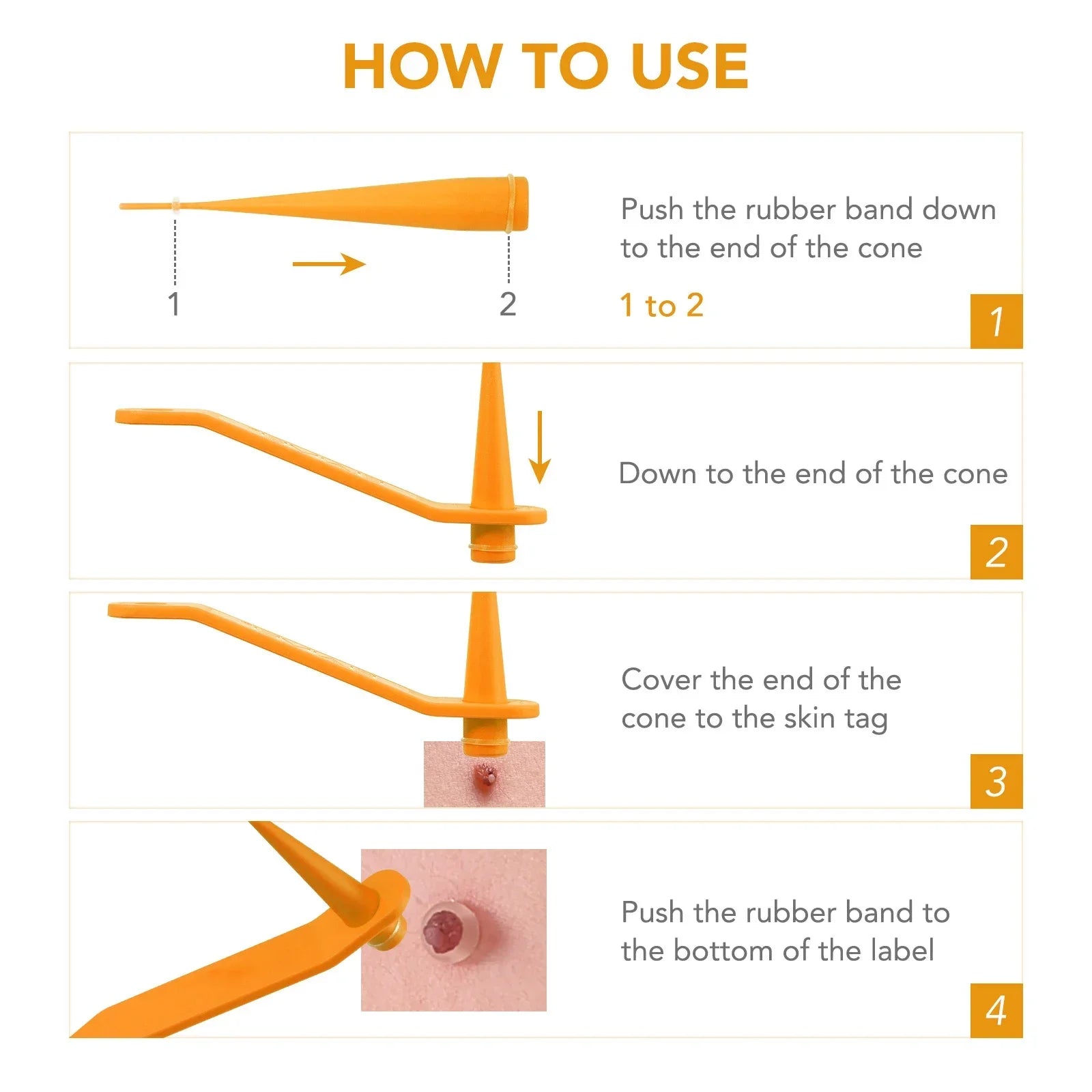 Skin Tag Removal Care Products Simple Wart Removal Tool Set Skin Tag Removeal Tool Easy To Clean Skin Care Tool